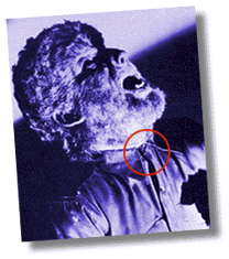 Exhibit A - Top button fastened.